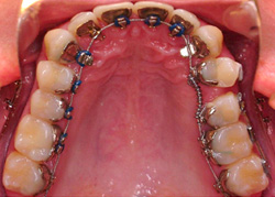 icognito patient example